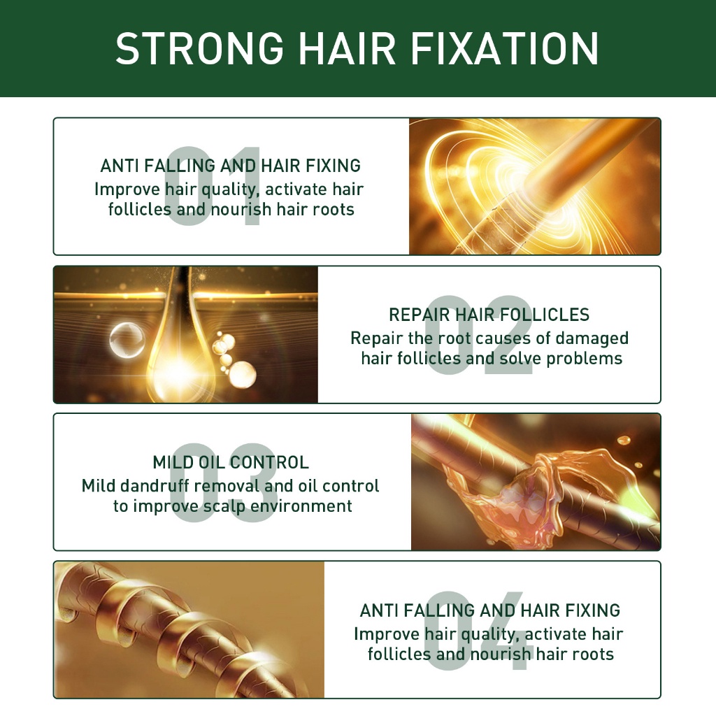 Serum mọc tóc Tinh chất dưỡng tóc Tinh Chất Chống Rụng Tóc 30ml kích thích mọc tóc nhanh làm dày（Hiệu quả sau 7 ngày） giúp giảm rụng tóc giải quyết vấn đề rụng tóc do lão hóa / hói đầu sau sinh