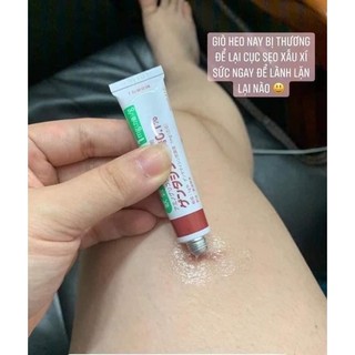 Kem bôi sẹo Gentacin Nhật