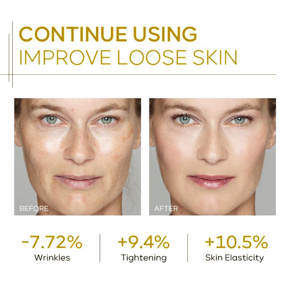 Soug Kem collagen Dưỡng Ẩm Nâng Cơ Săn Chắc Da Mặt