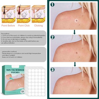 120 miếng dán trị mụn cóc trị mụn cóc nốt ruồi Bri