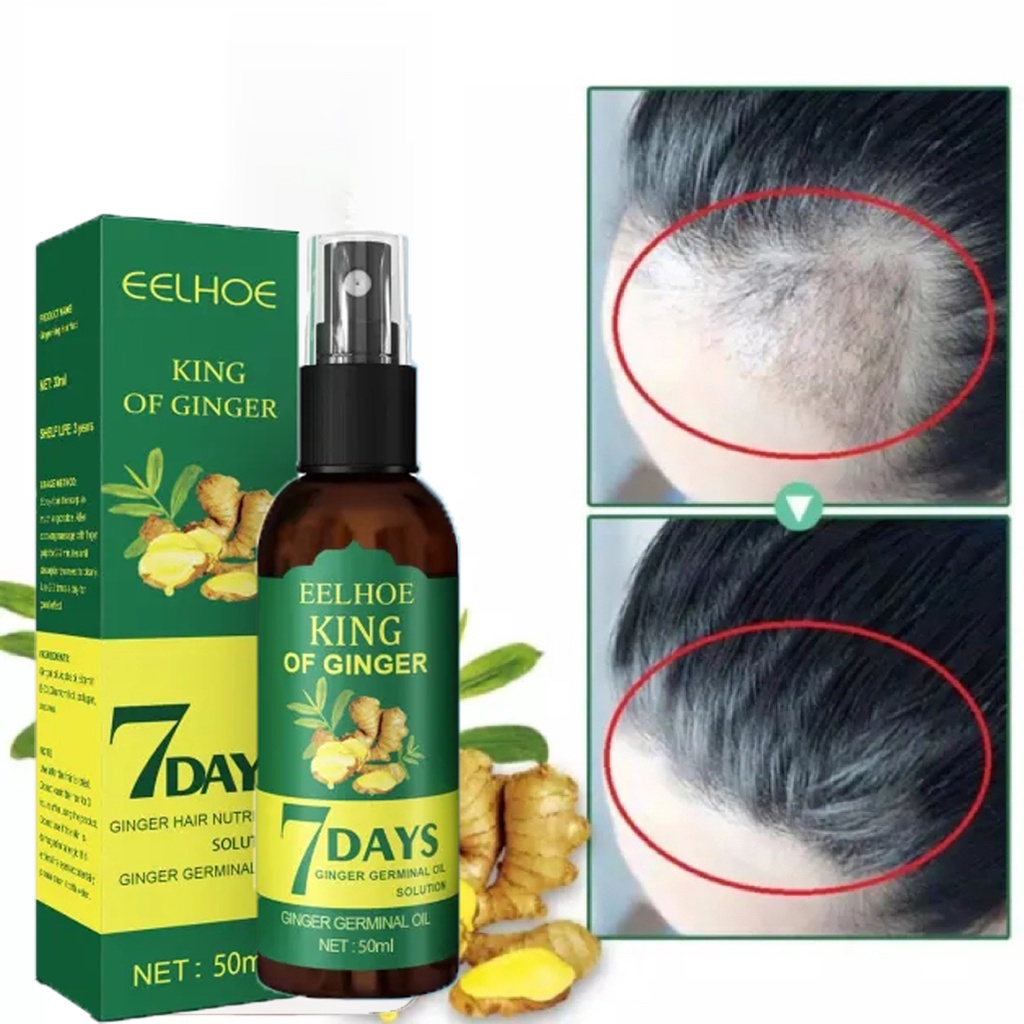 7 days Xịt Mọc Tóc EELHOE Tinh Chất Gừng Tươi Kích Thích Mọc Tóc, Giảm Gãy Rụng, Giúp Tóc Chắc Khỏe Sau 7 Ngày 30ml