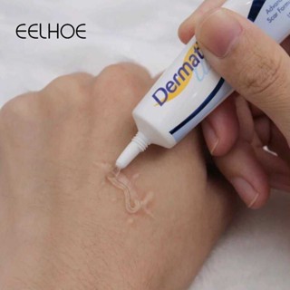 EELHOE Scar Gel Dermatix Scar Gel Điều trị sẹo mụn Kem xóa sẹo 15ml