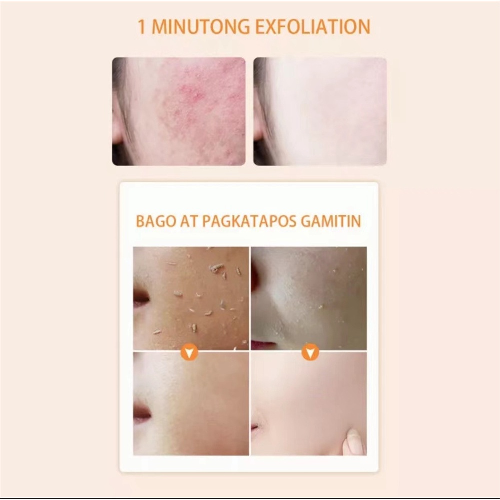 Mintox gel Tẩy Tế Bào Chết Toàn Thân Làm Sạch Sâu Dưỡng Ẩm Làm Trắng Da