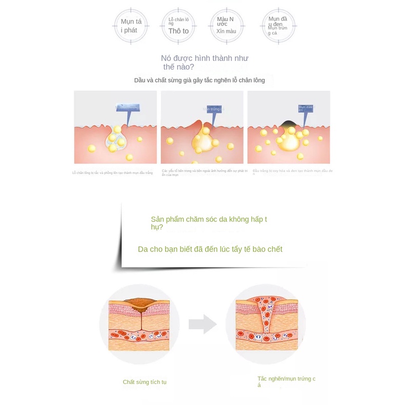 Gel Tẩy Tế Bào Chết 100g Chiết Xuất Lô Hội Làm Sạch Sâu Cho Da Mặt Và Toàn Thân