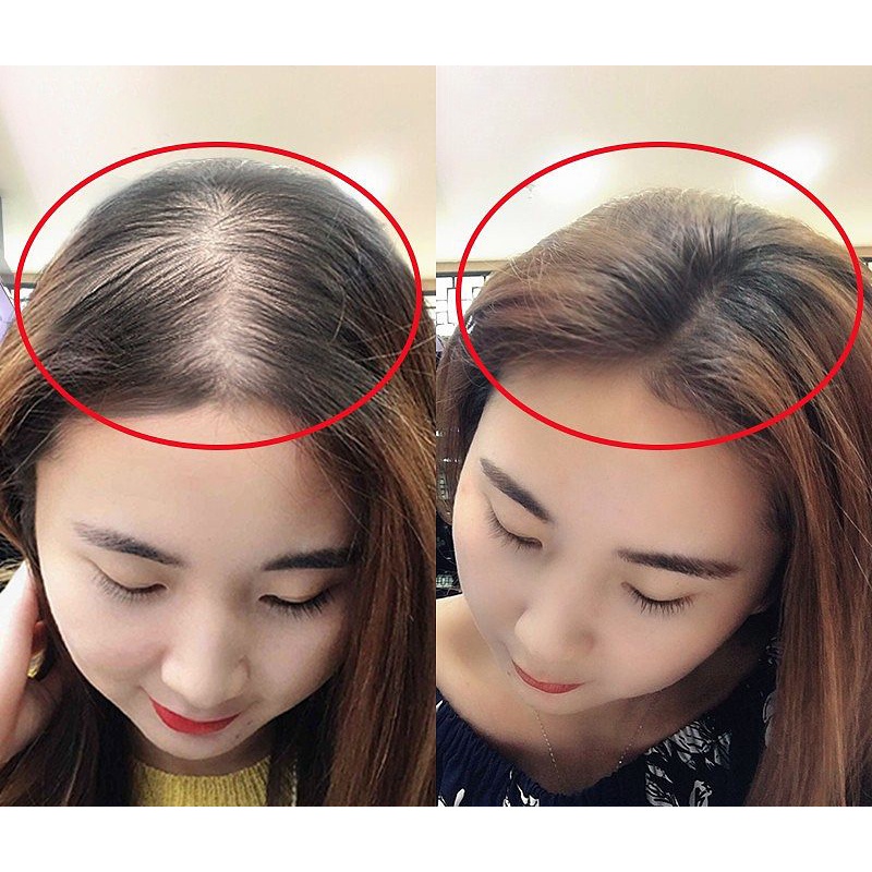 Dầu gội tinh chất gừng chống rụng tóc dưỡng ẩm mềm tóc Sadoer 500ml  / Dầu xả / Tinh dầu dưỡng tóc / Mặt nạ tóc  S12