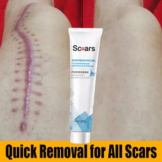 Kem mờ sẹo mờ thâm sẹo lồi sẹo lõm sẹo do mụn và giảm rạn da hiệu quả 20g nhanh chóng làm mờ sẹo lồi sẹo lõm