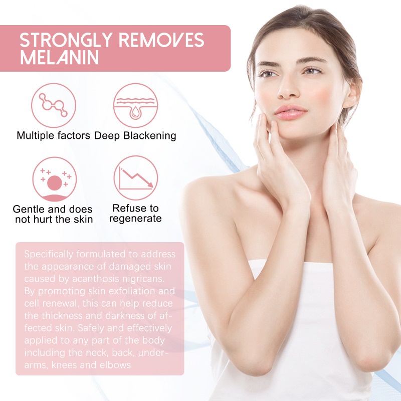 Kem Dưỡng Trắng Da Toàn Thân Kasys Làm Mờ Đốt Đen Dưỡng Ẩm