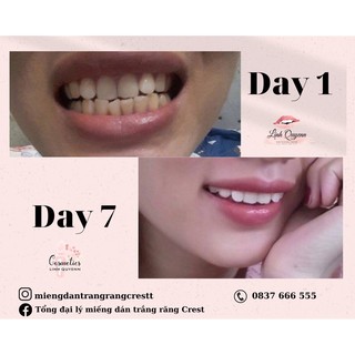 Kem đánh răng Crest 3D White Advanced Tripple Whitening 147G
