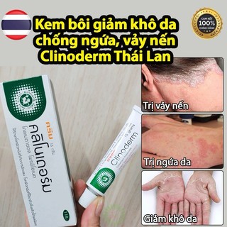 -𝐌𝐨𝐨𝐌𝐨𝐨- Kem bôi vảy n.ến, khô da Clinoderm Thái Lan tuýp 15g. kem clinoderm