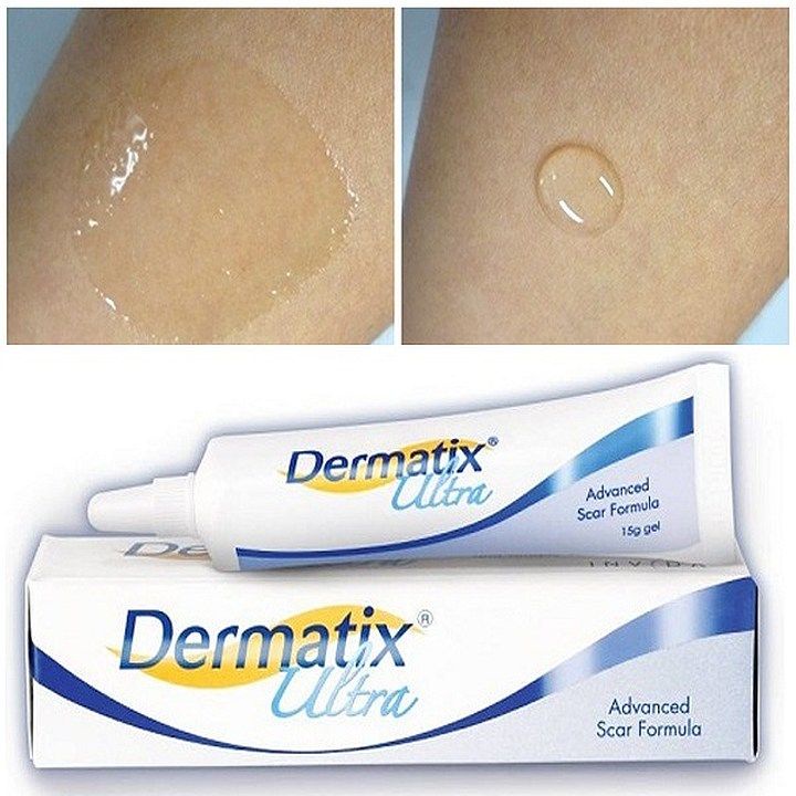 【miễn thuế nhập khẩu】Kem bôi sẹo dermatix ultra 15g vết sẹo bỏng vết mổ đẻ mờ dần