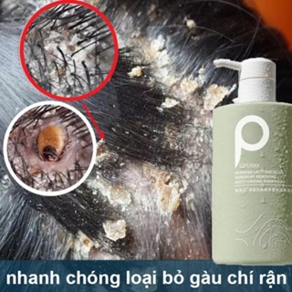 Dầu gội sạch gàu Dầu Gội Trị Gàu Dầu gội loại bỏ mạt dầu gội giảm ngứa 500ml làm sạch sâu da đầu ngứa ngáy/Shampoo