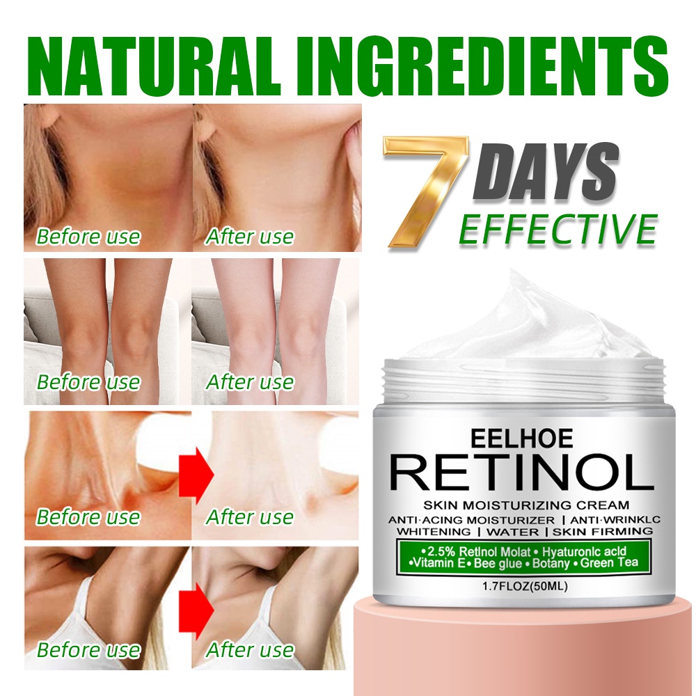 Lươn Retinol Sát Nách Trắng Da Sát Nách Chân Đầu Gối Thân Mật Công Thức Làm Trắng Nách Tẩy Trắng Da Kem 50G wine01