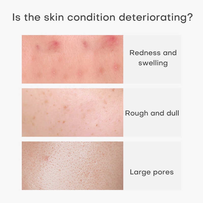 Yzkmskin serum Haematococus retinol retinol Se Khít Lỗ Chân Lông 50g Cải Thiện Nếp Nhăn Cho Da Mặt