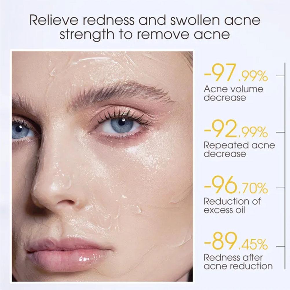 Salicylic Mặt Nạ Ngủ Dưỡng Ẩm Làm Sáng Da q6s0