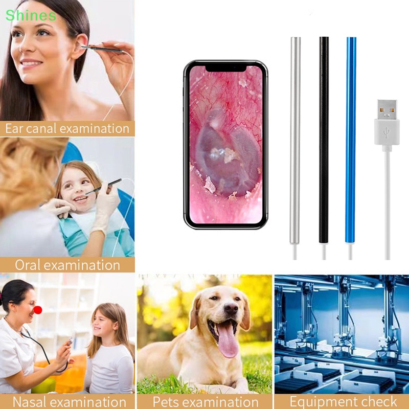 1 Bộ Dụng Cụ Lấy Ráy Tai Thông Minh 5.5mm Có camera Quan Sát Lỗ Tai vn