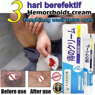 Nhật Bản kem bôi trĩ Gel bôi trĩ Kem trĩ 20g Nhanh chóng tiêu diệt trĩ, Co Búi Trĩ Giảm Đau Ngứa Vùng Hậu Môn