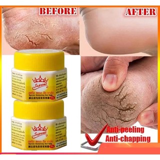 01 Tuýp Kem Dưỡng Phụ Hồi Da Chân & Gót Chân JOJI Secret Young Soft Feet And Heels Banana Cream 20g Thái Lạn