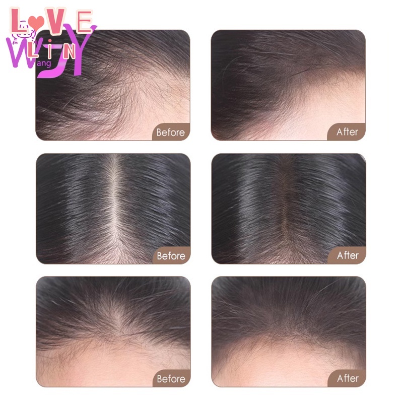 Phấn Phủ Chân Tóc Chống Thấm Nước Và Mồ Hôi lovelin
