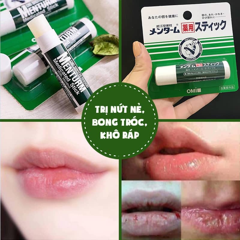 Son dưỡng môi Omi Menturm Nhật Bản - 4g