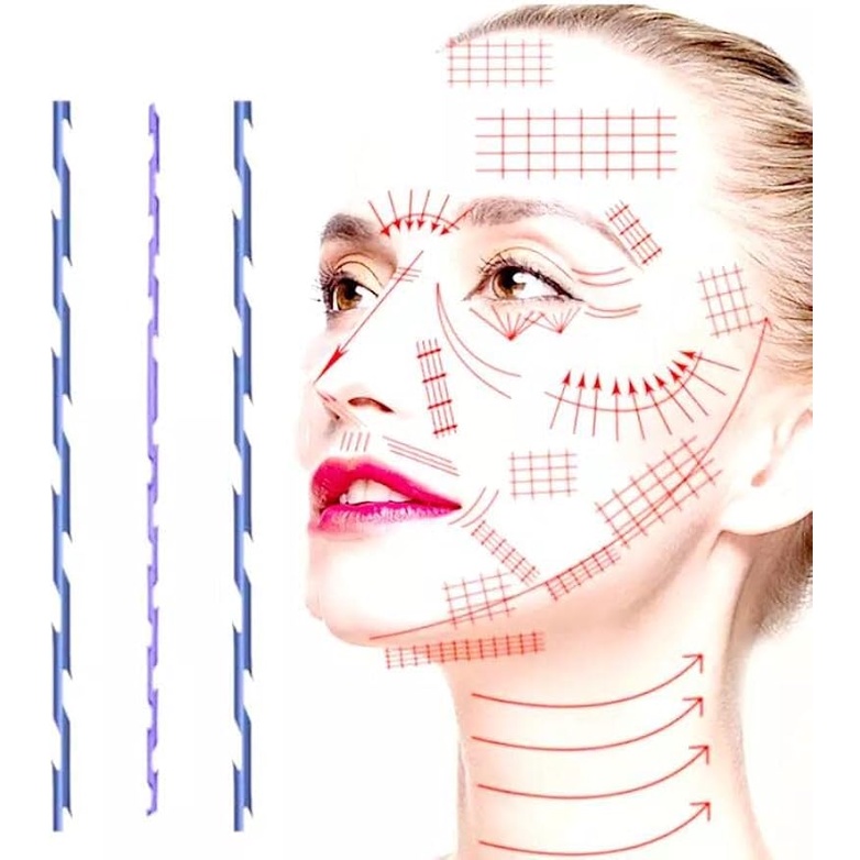 Set 20 Cuộn Chỉ pdo pcl Cho Nâng Mặt Toàn Thân Loại w-G100Mm