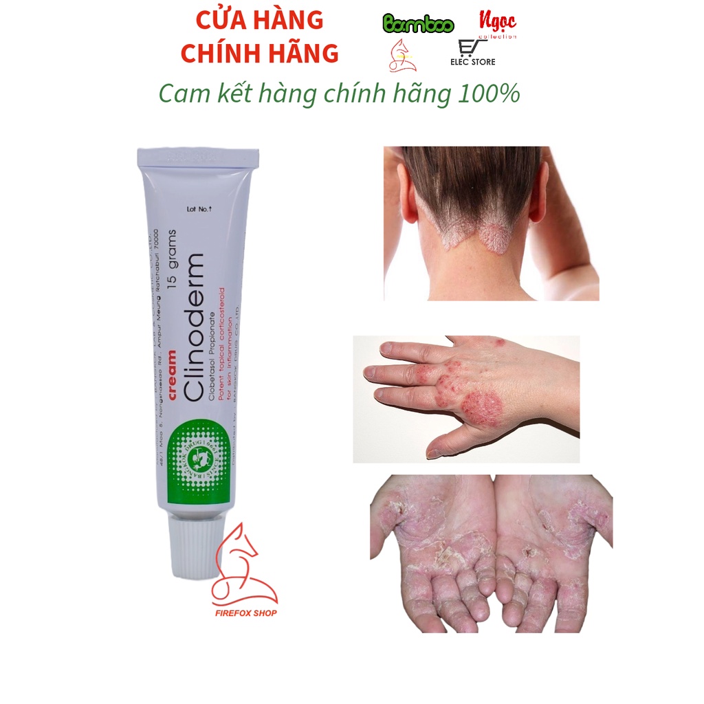 Kem Bôi Clinoderm 15 Gram Dưỡng Da Khô, Giảm Trừ Vẩy Nến - Thái Lan