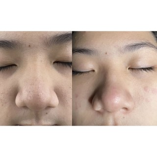 Bột ủ mụn HYDRATION GEL POWER