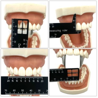 1 dụng cụ thước đo răng và nha khoa