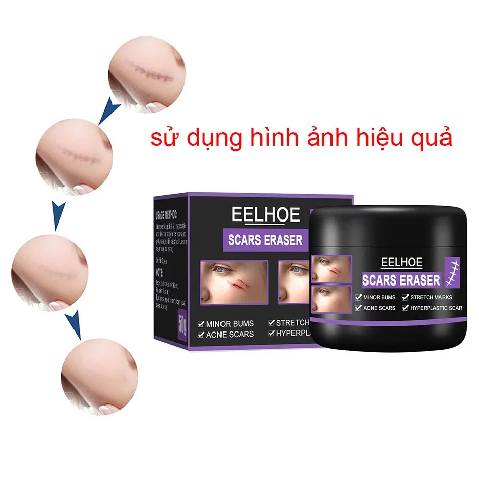 Kem xóa vết rạn da chống nhăn chống lão hóa cho phụ nữ Trẻ hóa làn da Xóa sẹo khi mang thai Chăm sóc cơ thể/50g- intl