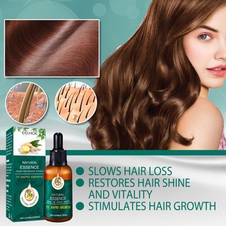 Serum Kích Thích Mọc Tóc 30ml Chống Rụng Tóc Hiệu Quả