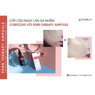 serum pdrn tế bào gốc kyunglab