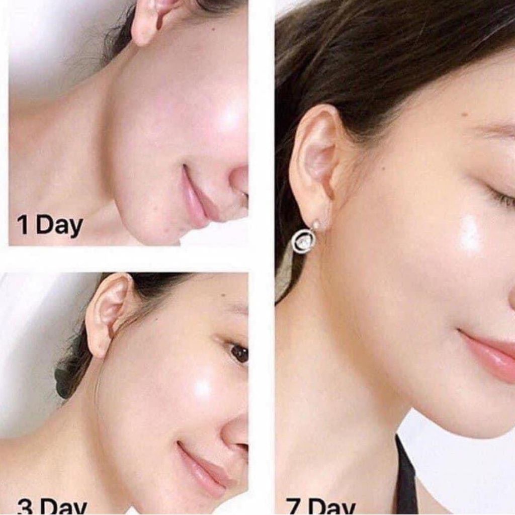 Kem Dưỡng OLAY Total Effect 7 in 1 Moisturiser - chính hãng - Voi Hồng Cosmetics