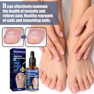 Tây & Tháng Chống Paronychia Giảm Dầu mọc Móng chân Chống nấm Ngón chân mọc ngược Móng tay Corrector Dừng đau Onychomycosis Điều trị Serum