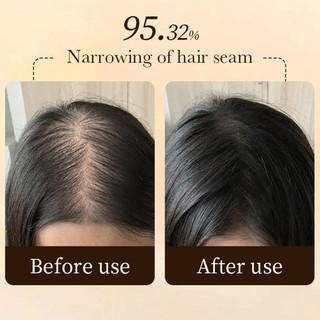 Tinh Chất Kích Thích Mọc Tóc Chống Rụng Tóc Hiệu Quả