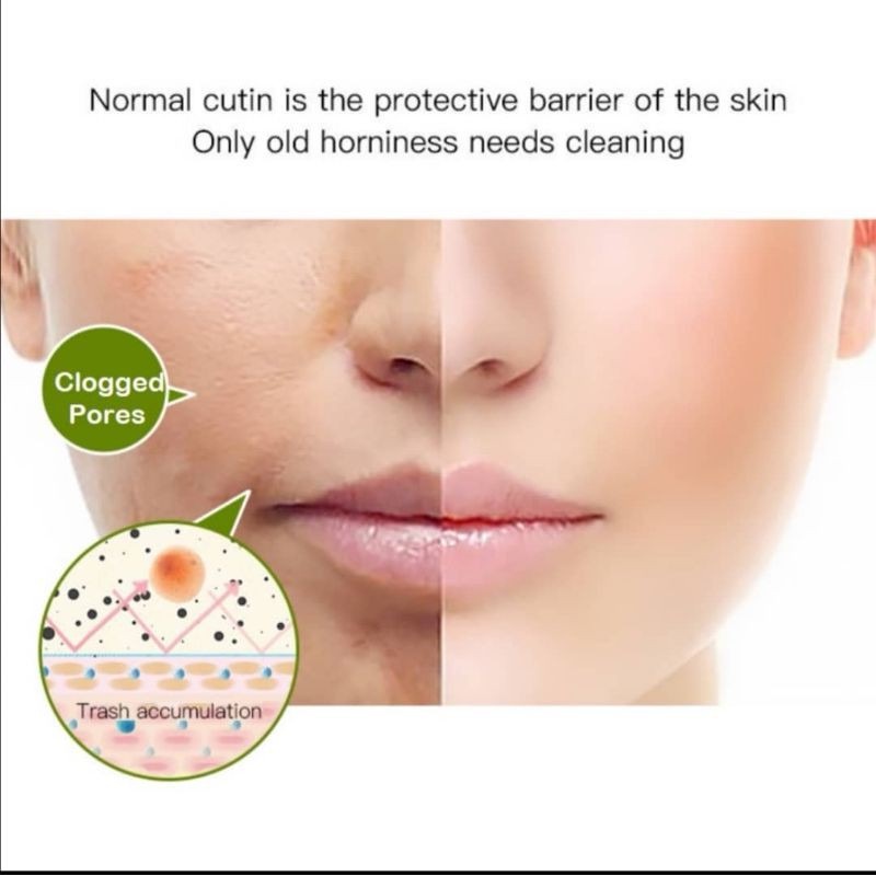 Axit Trái Cây Tẩy Tế Bào Chết Da Mặt Gel 50G Cho Hồng Làm Trắng Da Mặt 80G Da Mặt Tẩy Tế Bào Chết Toàn Thân Sữa Sâu Làm Trắng Da AubessDS