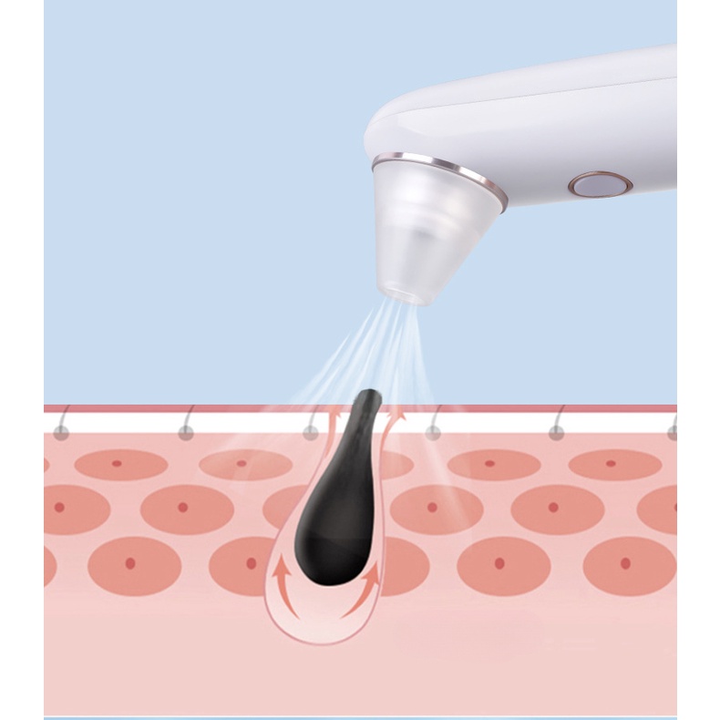 Visual Máy Hút Mụn Đầu Đen Nhỏ Làm Sạch Lỗ Chân Lông Đầu Đen Và Mụn Trứng Cá Điện Tử Làm Đẹp