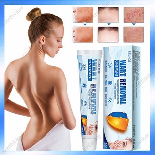 Kem trị mụn 20g cao cấp cho nam nữ