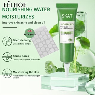 Kem Hỗ trợ giảm mụn + Miếng Dán Mụn Làm Sạch Sâu Lỗ Chân Lông Và Loại Bỏ Mụn Đầu Đen Tươi Mới Và Không Gây Khó Chịu 15g