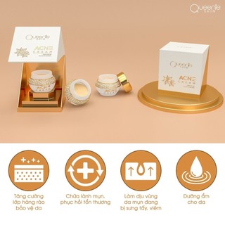 Kem face mụn quế hoa Queenie Skin ACNE Cream - giảm mụn, dưỡng da hiệu quả