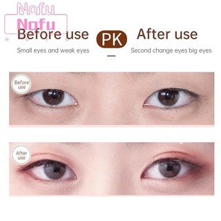 NOFU@Vỉ 48 miếng dán kích mí vân lưới