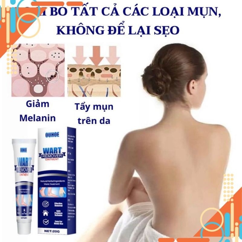 sg 11134201 7rcbt lt1doycubpar32