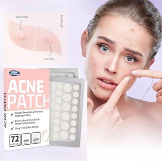 72 Chiếc Miếng Dán Mụn Axit Salicylic Miếng Dán Mụn Dễ Thương Chống Thấm Nước Vô Hình Hydrocoloid Miếng Dán