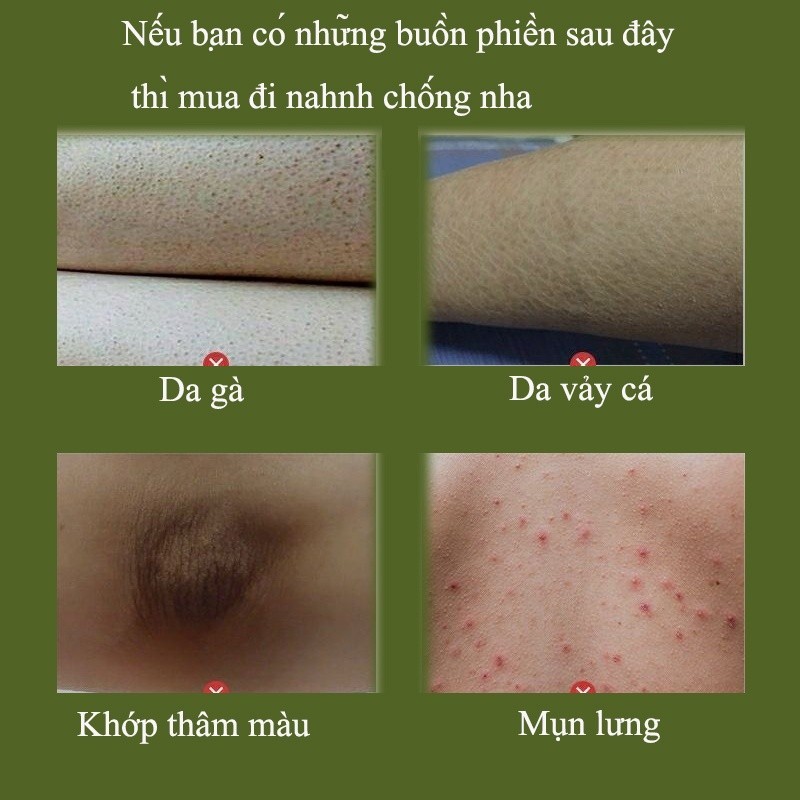 Tẩy tế bào chết body toàn thân tắm trắng toàn thân kem body trắng làm trắng dưỡng thu nhỏ lỗ chân lông | BigBuy360 - bigbuy360.vn