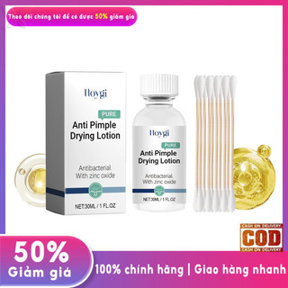 Kem Hỗ trợ giảm mụn làm sạch da mặt Sửa chữa mụn trứng cá, đánh dấu, mụn và loại bỏ miệng Kem chăm sóc da nhẹ