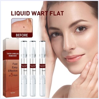 Xóa nốt ruồi Tẩy xóa Thẻ xóa & Loại bỏ nốt ruồi Gel không gây kích ứng tự nhiên Xóa thẻ & nốt ruồi Dễ dàng cho phépvn