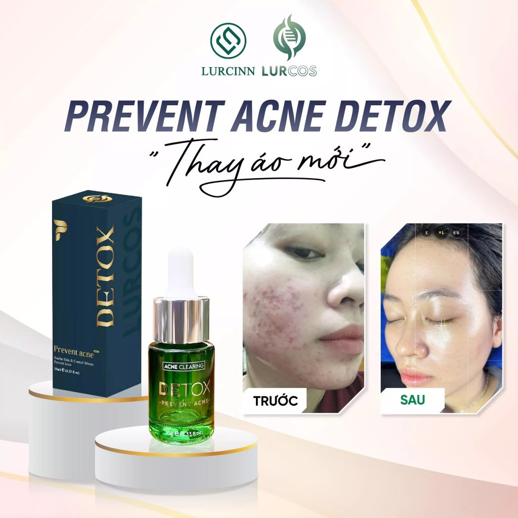 [Chính Hãng] Serum Chăm Sóc Da Mụn Mờ Thâm LURCINN Prevent Acne Detox 10ml