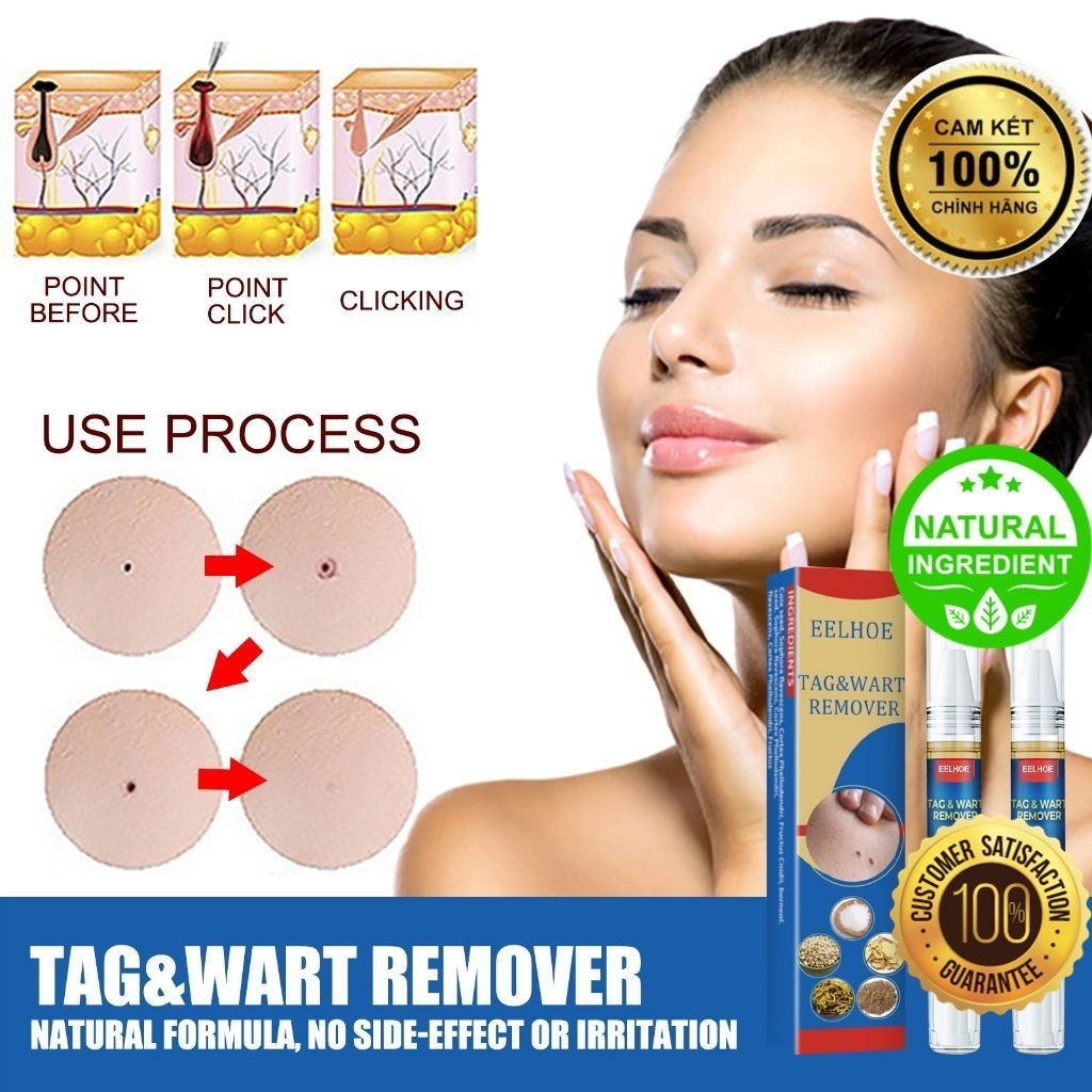 Bút EELHOE Chấm Mụn Thịt, Nốt Ruồi, Mụn Cóc, Mụn Thịt Thừa, cam kết an toàn và hiệu quả  [Herbal Mall]