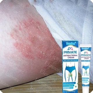 Kem bôi giúp giảm các triệu chứng ngứa viêm nấm vùng kín dành cho nam/20g
