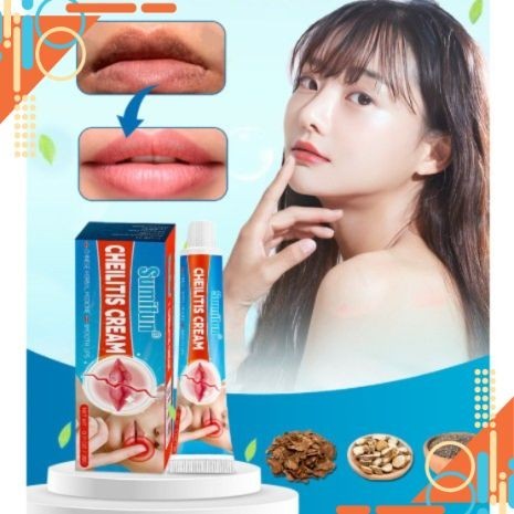 KEM BÔI HẠT FORDYCE CHEILITIS CREAM Của Sumifun - HTshop
