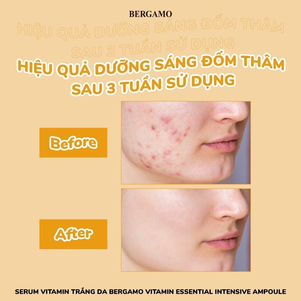 Serum Tinh Chất Bergamo Essential Intensive Ampoule Cấp Ẩm, Giảm Nếp Nhăn, Mờ Thâm Nám Hàn Quốc 150ml