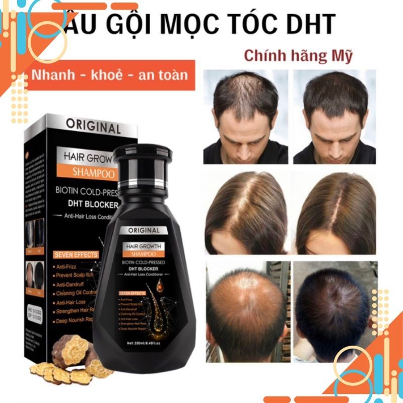 sg 11134201 7rccz lt1d7w732noma3